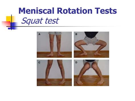 squat test for meniscal tear|meniscus tear physical exam.